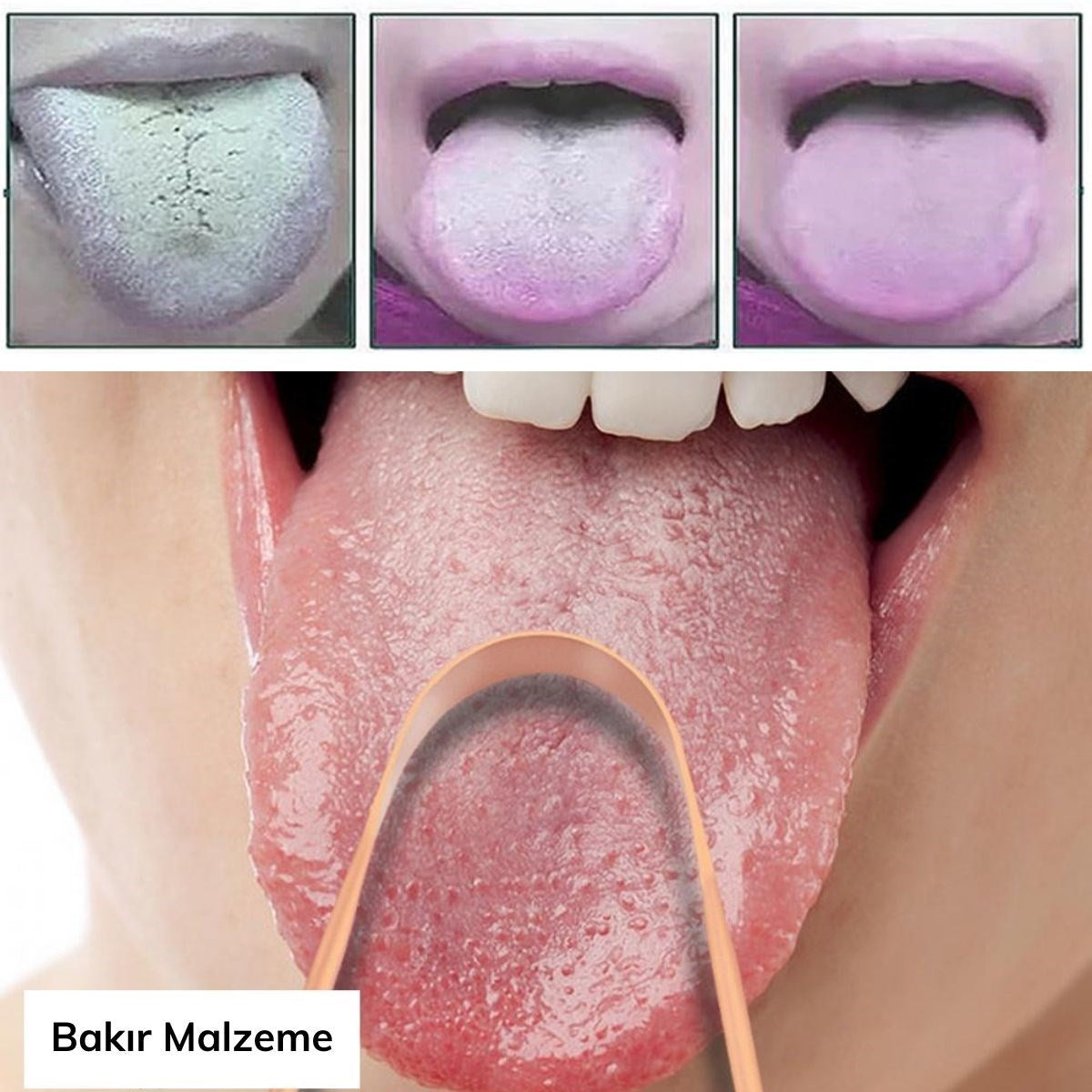 miorashop® Bakır Oil Pulling Yağ Çekme Dil Plak Temizleme Aleti Dil Fırçası Sıyırıcı Dil Kaşığı
