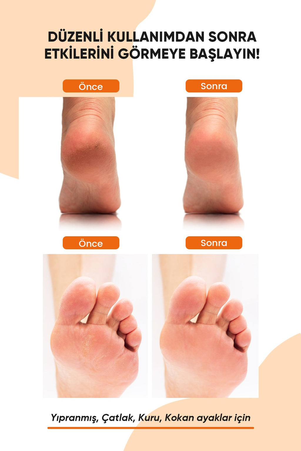 Topuk Çatlak ve Ayak Bakım Peeling Spreyi - Koku Giderici ve Nemlendirici Foot Care Spray 250ml